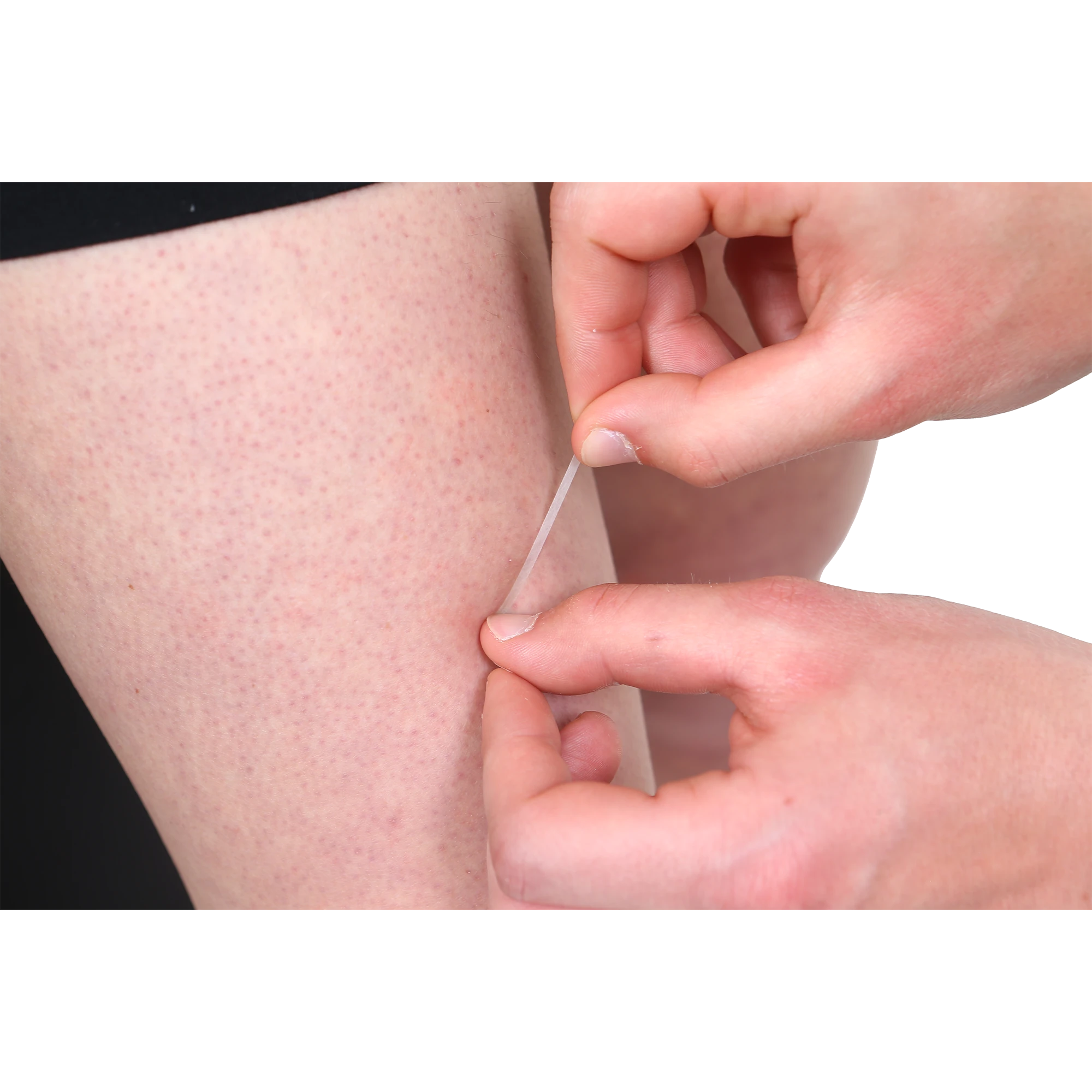 Fermeture de plaies - Sterile strips (5)